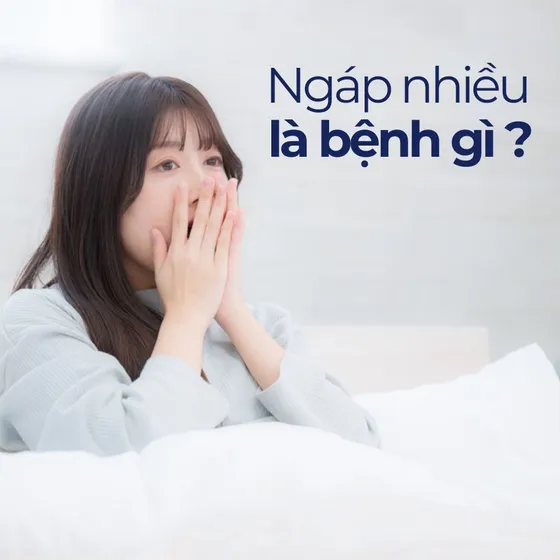 Ngáp nhiều là bệnh gì? Nguyên nhân ngáp liên tục trong ngày Ngáp nhiều là bệnh gì? Nguyên nhân ngáp liên tục trong ngày