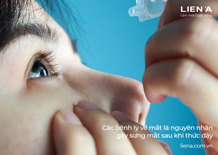 làm sao khi sưng mắt