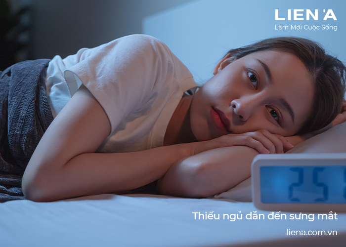 sưng mắt khi ngủ dậy là sao