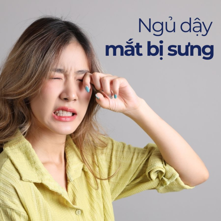 ngủ dậy mắt bị sưng
