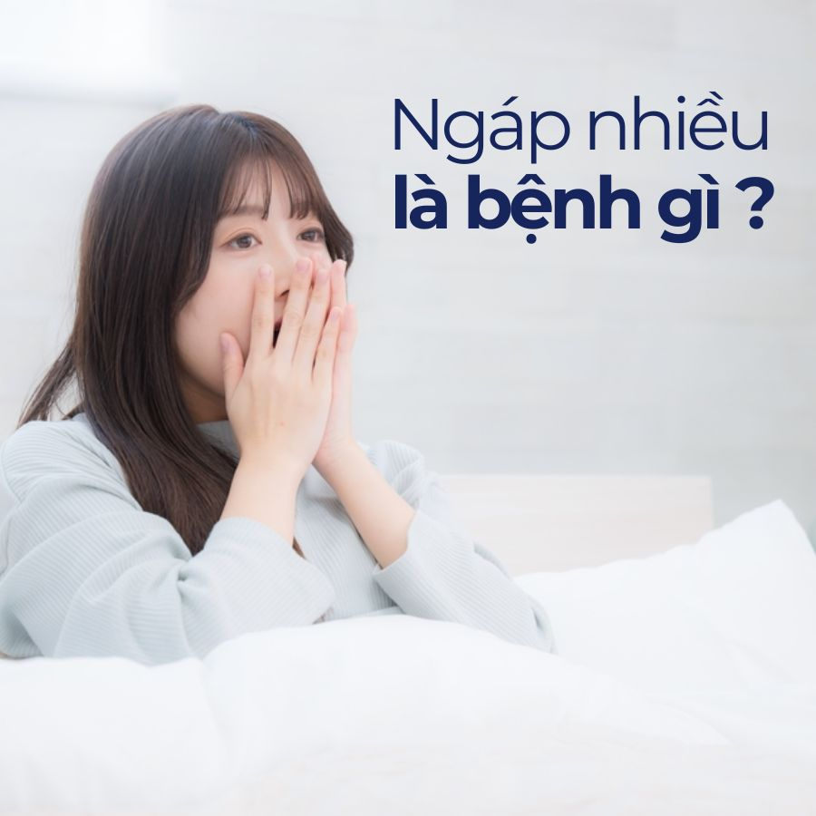 Ngáp nhiều là bệnh gì? Nguyên nhân ngáp liên tục trong ngày Ngáp nhiều là bệnh gì? Nguyên nhân ngáp liên tục trong ngày