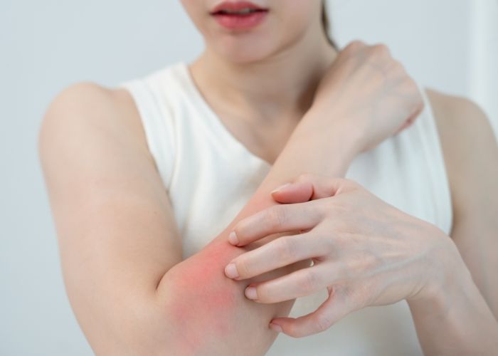 người bị dị ứng nên chọn nệm cẩn thận