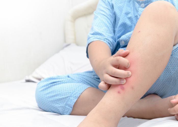 rủi ro khi dùng giường cũ